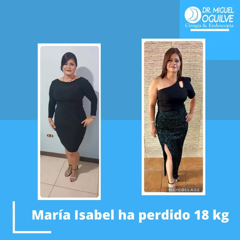 Caso de éxito antes y después Dr. Miguel Oguilve