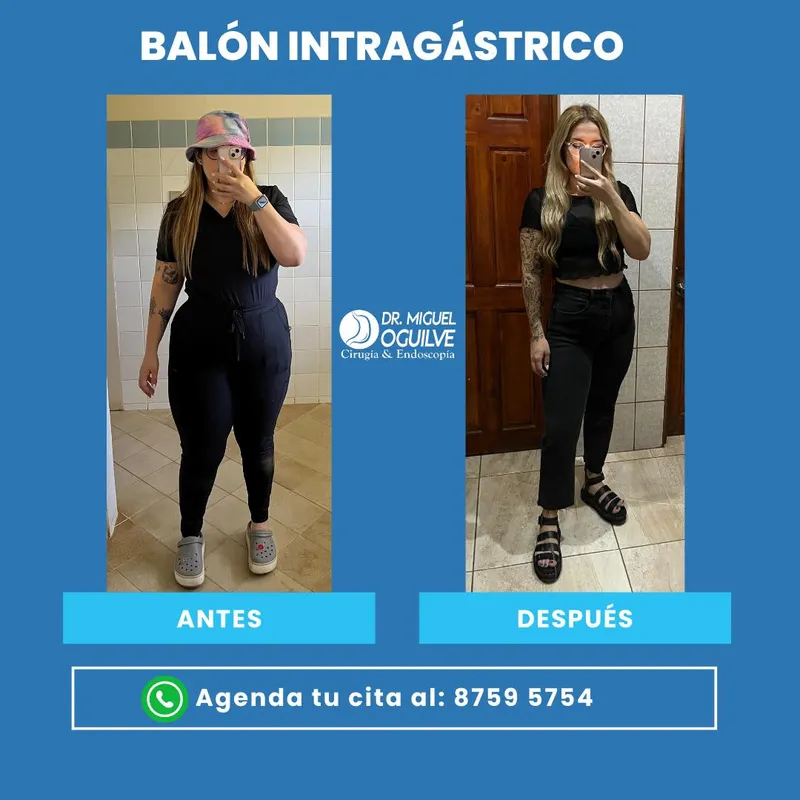 Caso de éxito antes y después Dr. Miguel Oguilve