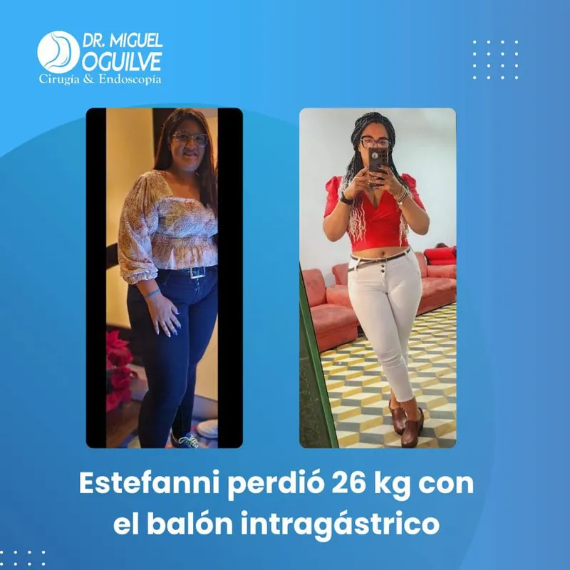 Caso de éxito antes y después Dr. Miguel Oguilve