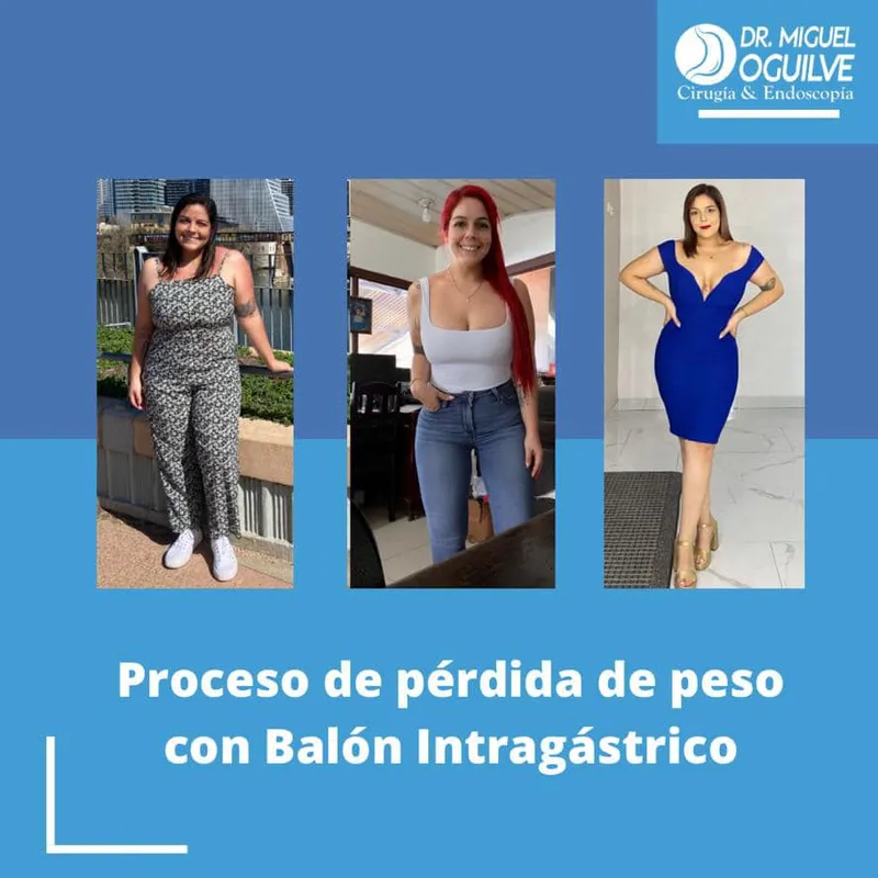 Caso de éxito antes y después Dr. Miguel Oguilve