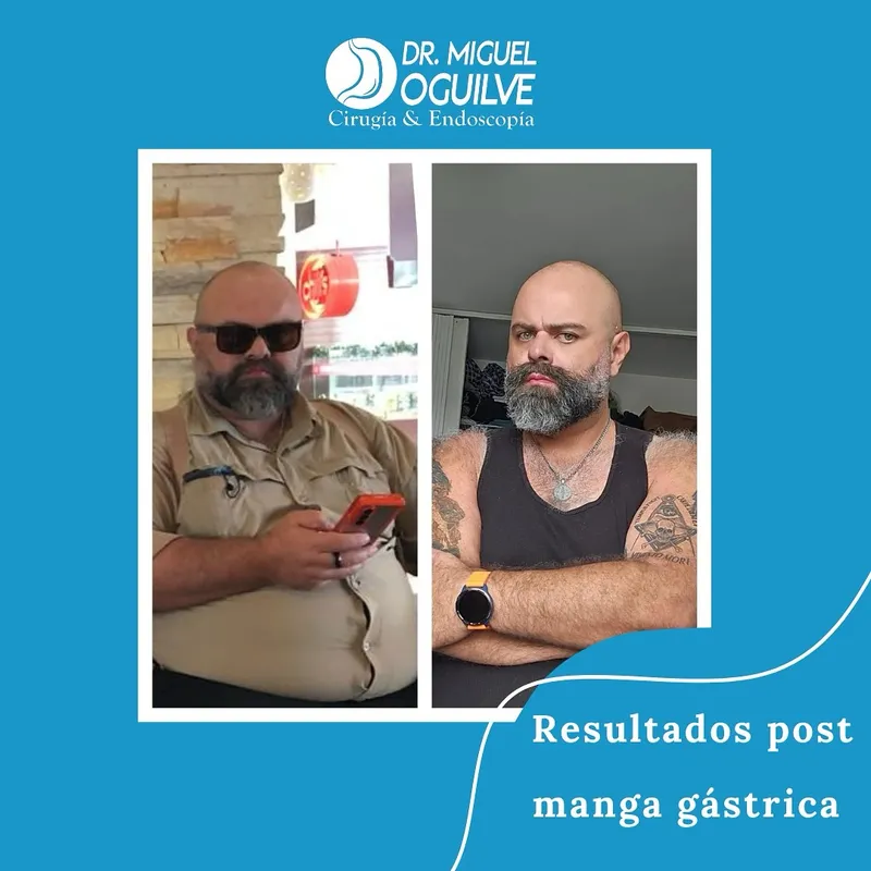 Caso de éxito antes y después Dr. Miguel Oguilve