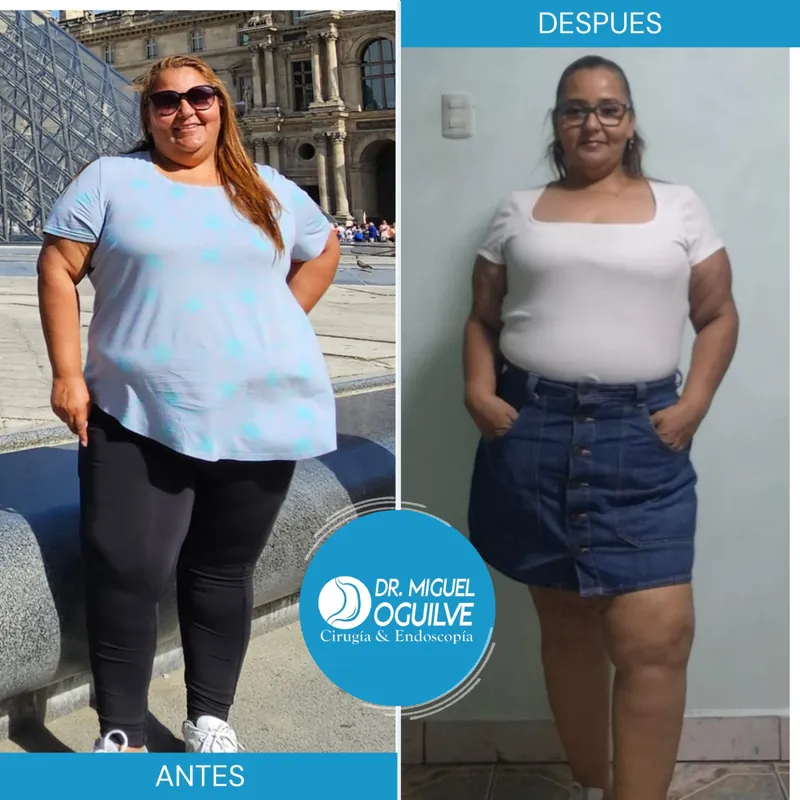 Caso de éxito antes y después Dr. Miguel Oguilve
