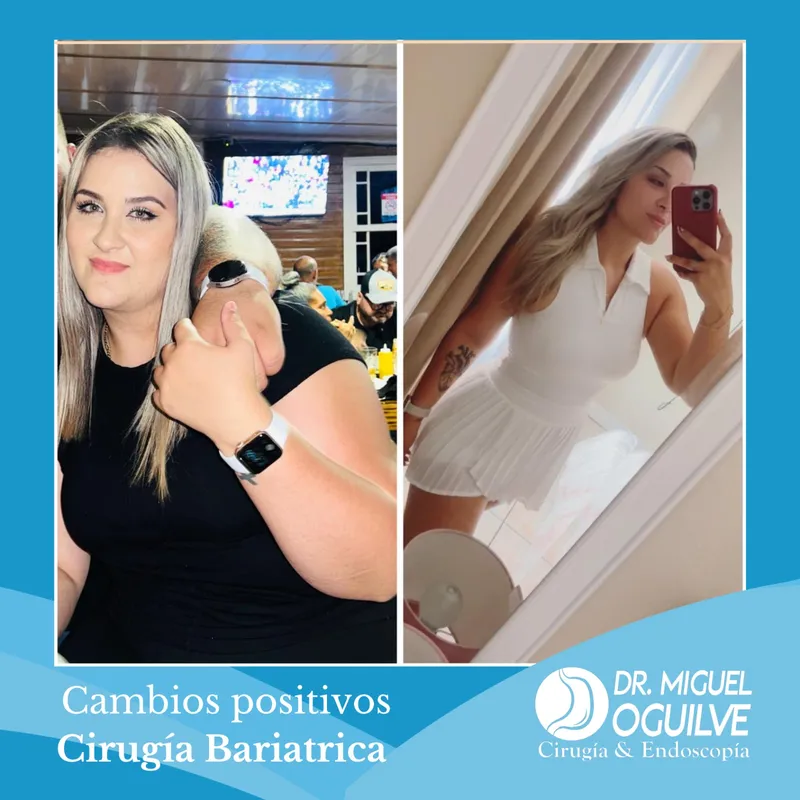 Caso de éxito antes y después Dr. Miguel Oguilve