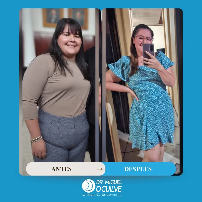 Caso de éxito antes y después Dr. Miguel Oguilve