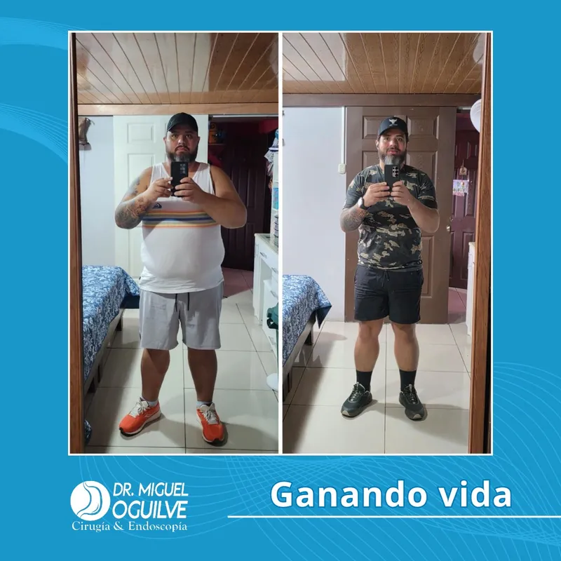 Caso de éxito antes y después Dr. Miguel Oguilve
