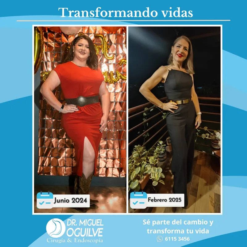 Caso de éxito antes y después Dr. Miguel Oguilve