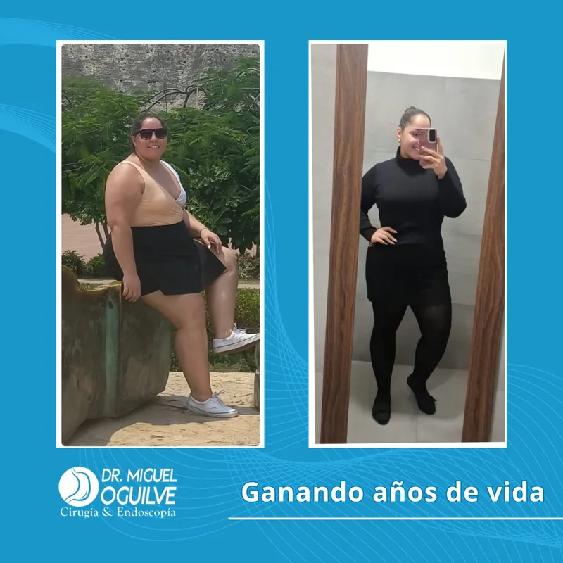 Caso de éxito antes y después Dr. Miguel Oguilve