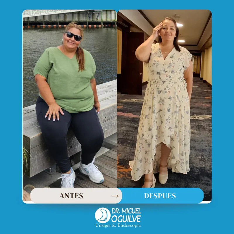Caso de éxito antes y después Dr. Miguel Oguilve