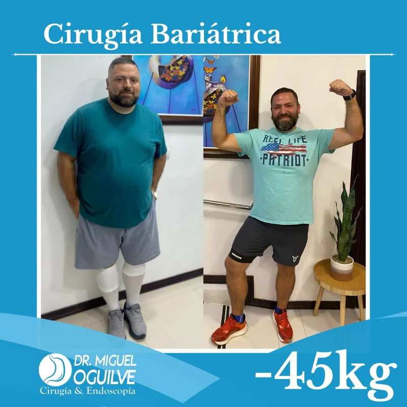 Caso de éxito antes y después Dr. Miguel Oguilve