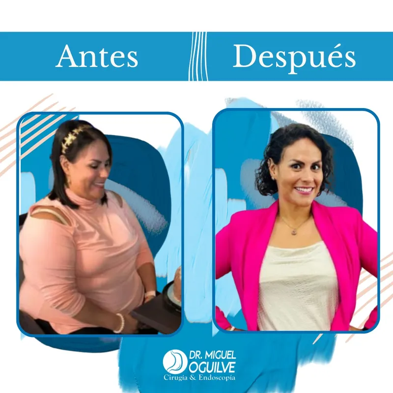 Caso de éxito antes y después Dr. Miguel Oguilve