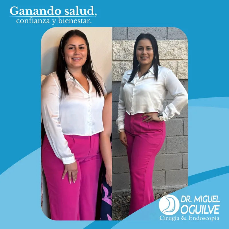 Caso de éxito antes y después Dr. Miguel Oguilve