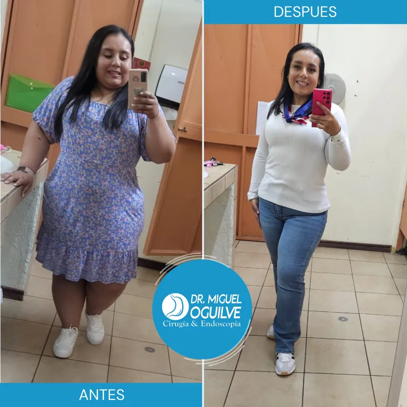 Caso de éxito antes y después Dr. Miguel Oguilve