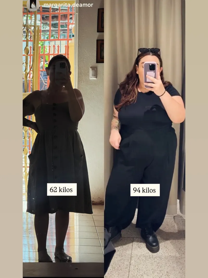 Caso de éxito antes y después Dr. Miguel Oguilve